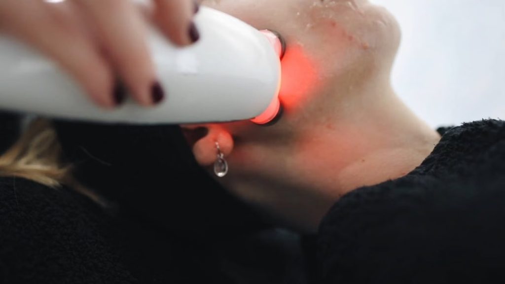 Imagen de referencia de radiofrecuencia facial con cabezal multipolar. Fotografía de Polina Tankilevitch, Pexels.